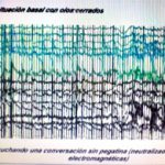 EEG Telefonat 150x150